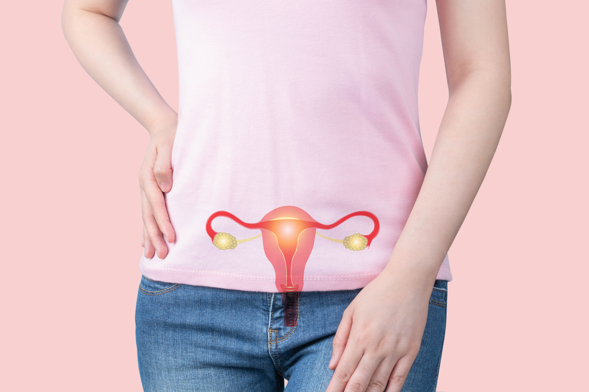 多嚢胞性卵巣症候群(PCOS)